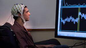 AI and rapid-response electroencephalograms (EEGs) enhance delirium detection.